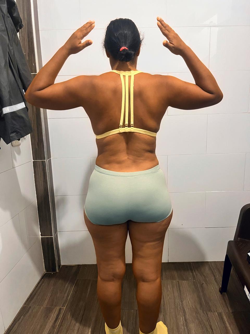 Antes espalda