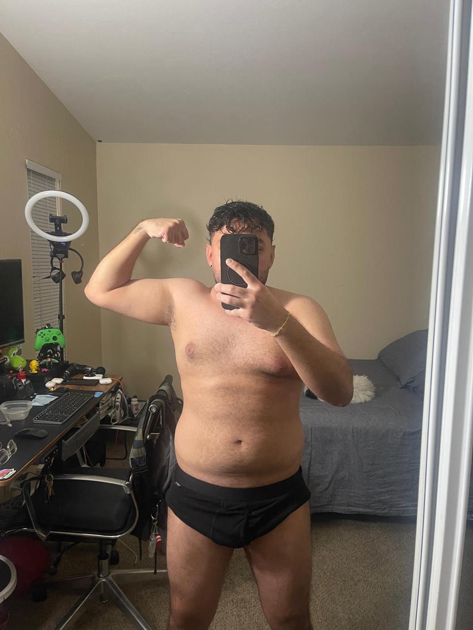 Antes frente brazo 2